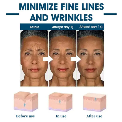 🫧🩵Last Day to Save 𝟕𝟎%! 🌿 𝐅𝐮𝐛𝐬𝐭𝐚™ Skin Lifting Wrinkle Removal Serum – ✨Rejuvenate and Tighten Your Skinkin! 🧖‍♀️