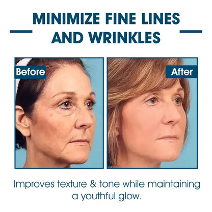 🫧🩵Last Day to Save 𝟕𝟎%! 🌿 𝐅𝐮𝐛𝐬𝐭𝐚™ Skin Lifting Wrinkle Removal Serum – ✨Rejuvenate and Tighten Your Skinkin! 🧖‍♀️