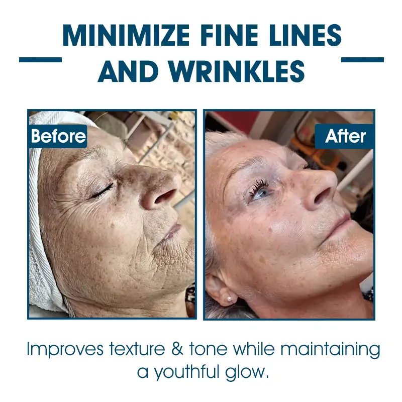 🫧🩵Last Day to Save 𝟕𝟎%! 🌿 𝐅𝐮𝐛𝐬𝐭𝐚™ Skin Lifting Wrinkle Removal Serum – ✨Rejuvenate and Tighten Your Skinkin! 🧖‍♀️