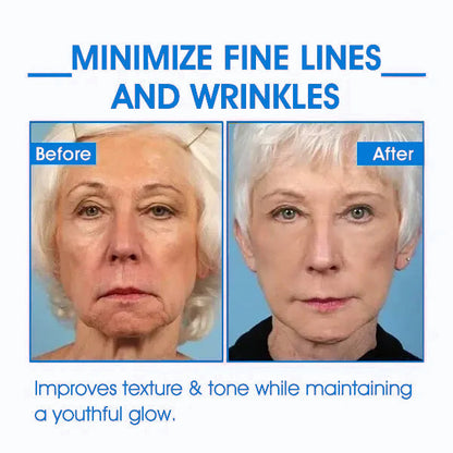 𝐋𝐚𝐬𝐭 𝐃𝐚𝐲 𝐃𝐢𝐬𝐜𝐨𝐮𝐧𝐭: 𝟕5% 𝐎𝐅𝐅❄️☄️𝐅𝐮𝐛𝐬𝐭𝐚® Advanced SkinTightening Rejuvenating Cream: Restore Skin Elasticity💦