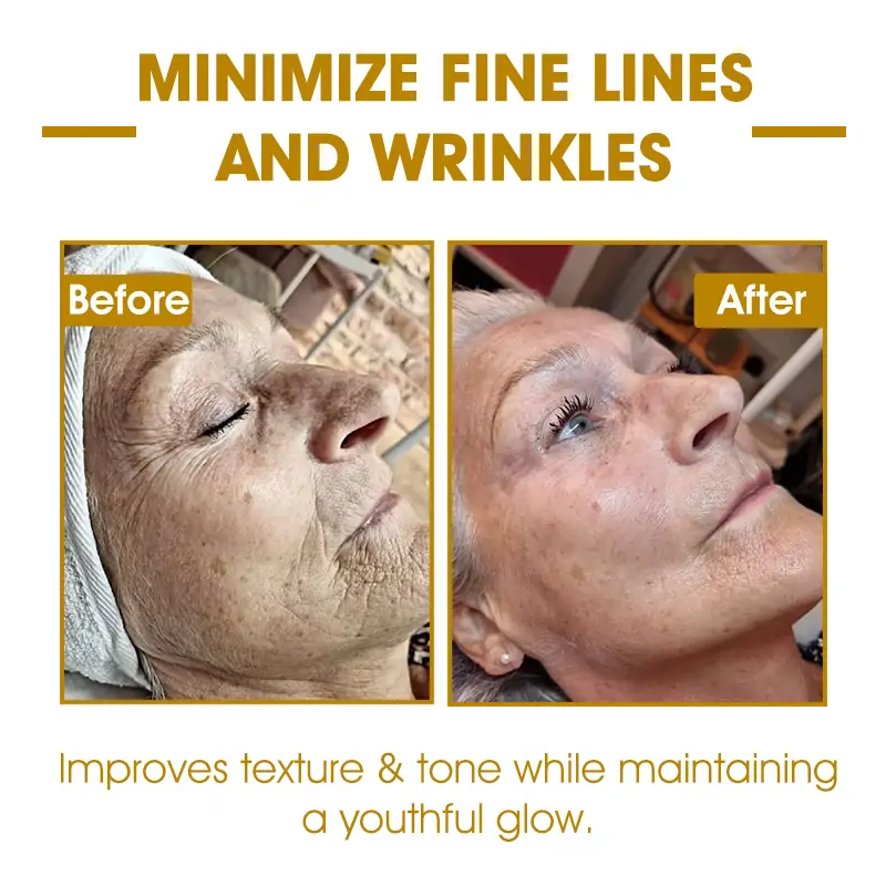 𝐋𝐚𝐬𝐭 𝐃𝐚𝐲 𝐃𝐢𝐬𝐜𝐨𝐮𝐧𝐭: 85% 𝐎𝐅𝐅  𝐅𝐮𝐛𝐬𝐭𝐚® Ultra-Firming + Repairing Multi-Purpose Cream: Restore Skin Elasticity