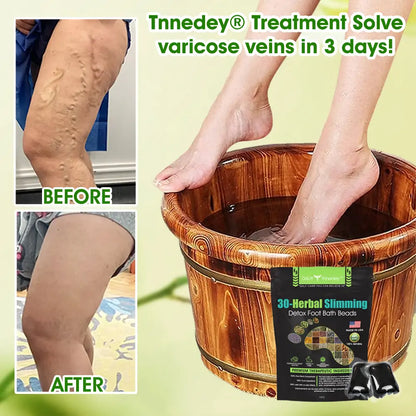 Tnnedey® 30 Herbal Firming Slimming & Detox Foot Bath Beads - Effective Treatment for High Blood Sugar and Arthritis