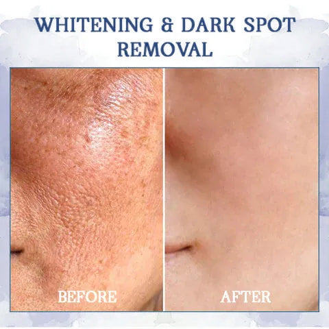 🔥𝐋𝐚𝐬𝐭 𝐃𝐚𝐲 𝐃𝐢𝐬𝐜𝐨𝐮𝐧𝐭: 𝟕5% 𝐎𝐅𝐅🫧𝐅𝐮𝐛𝐬𝐭𝐚® Advanced Firming & Wrinkle-Reducing Cream: Restore Skin Elasticity