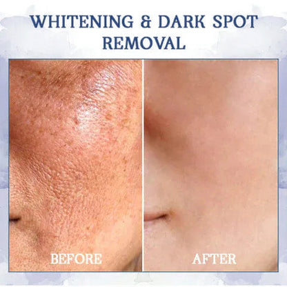 🔥𝐋𝐚𝐬𝐭 𝐃𝐚𝐲 𝐃𝐢𝐬𝐜𝐨𝐮𝐧𝐭: 𝟕5% 𝐎𝐅𝐅🫧𝐅𝐮𝐛𝐬𝐭𝐚® Advanced Firming & Wrinkle-Reducing Cream: Restore Skin Elasticity