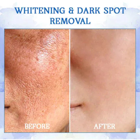 𝐋𝐚𝐬𝐭 𝐃𝐚𝐲 𝐃𝐢𝐬𝐜𝐨𝐮𝐧𝐭: 𝟕5% 𝐎𝐅𝐅❄️☄️𝐅𝐮𝐛𝐬𝐭𝐚® Advanced SkinTightening Rejuvenating Cream: Restore Skin Elasticity💦