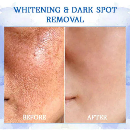 𝐋𝐚𝐬𝐭 𝐃𝐚𝐲 𝐃𝐢𝐬𝐜𝐨𝐮𝐧𝐭: 𝟕5% 𝐎𝐅𝐅❄️☄️𝐅𝐮𝐛𝐬𝐭𝐚® Advanced SkinTightening Rejuvenating Cream: Restore Skin Elasticity💦