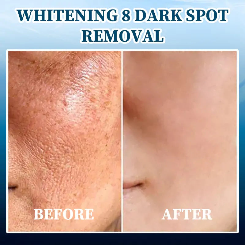 🫧🩵Last Day to Save 𝟕𝟎%! 🌿 𝐅𝐮𝐛𝐬𝐭𝐚™ Skin Lifting Wrinkle Removal Serum – ✨Rejuvenate and Tighten Your Skinkin! 🧖‍♀️