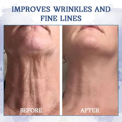 🔥𝐋𝐚𝐬𝐭 𝐃𝐚𝐲 𝐃𝐢𝐬𝐜𝐨𝐮𝐧𝐭: 𝟕5% 𝐎𝐅𝐅🫧𝐅𝐮𝐛𝐬𝐭𝐚® Advanced Firming & Wrinkle-Reducing Cream: Restore Skin Elasticity