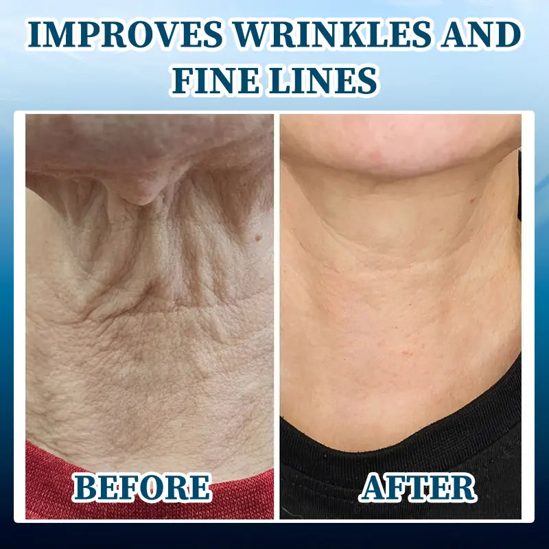 🫧🩵Last Day to Save 𝟕𝟎%! 🌿 𝐅𝐮𝐛𝐬𝐭𝐚™ Skin Lifting Wrinkle Removal Serum – ✨Rejuvenate and Tighten Your Skinkin! 🧖‍♀️