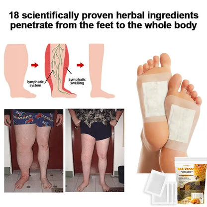 𝐓𝐧𝐧𝐞𝐝𝐞𝐲™ Bee Venom 𝐋𝐲𝐦𝐩𝐡𝐚𝐭𝐢𝐜 𝐃𝐫𝐚𝐢𝐧𝐚𝐠𝐞 & 𝐒𝐥𝐢𝐦𝐦𝐢𝐧𝐠 Foot Patches - 𝐓𝐚𝐫𝐠𝐞𝐭 𝐒𝐰𝐞𝐥𝐥𝐢𝐧𝐠 & 𝐃𝐞𝐭𝐨𝐱 Naturally 🌿👣