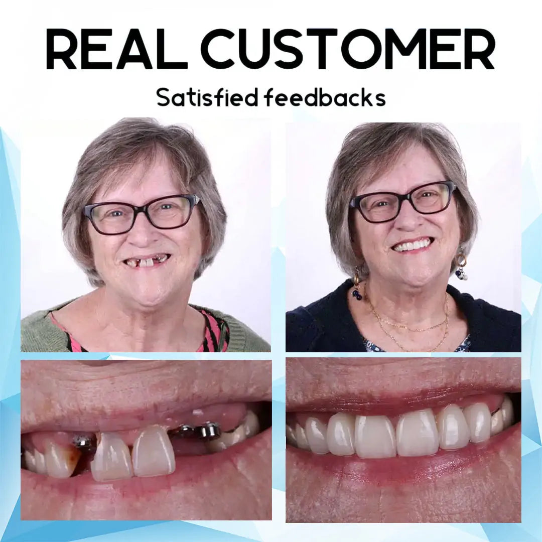 【𝑂𝐹𝐹𝐼𝐶𝐼𝐴𝐿 𝑆𝑇𝑂𝑅𝐸】𝘽𝙞𝙠𝙚𝙣𝙙𝙖™ Premium Custom Silicone Denture Set(⏰Limited time discount Last 30 minutes⏰)